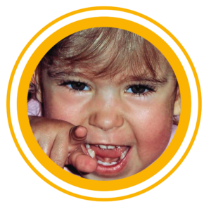 Stiftung Augenblick Spina bifida hydrocephalus Lächeln schenken gutes tun offener Rücken Wasserkopf