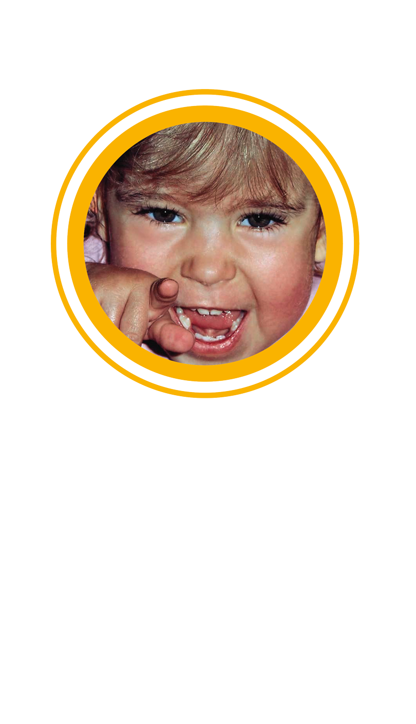 Stiftung Augenblick Spina bifida hydrocephalus Lächeln schenken gutes tun offener Rücken Wasserkopf