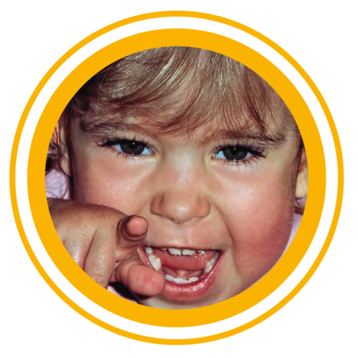 Stiftung Augenblick Spina bifida hydrocephalus Lächeln schenken gutes tun offener Rücken Wasserkopf